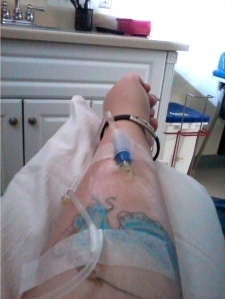 Steroid Infusion